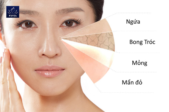 Đặc điểm của Làn Da Mỏng và Yếu